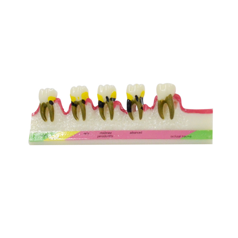 Medical Lab Study - Modelo de enfermedad Periodontal, materiales dentales,