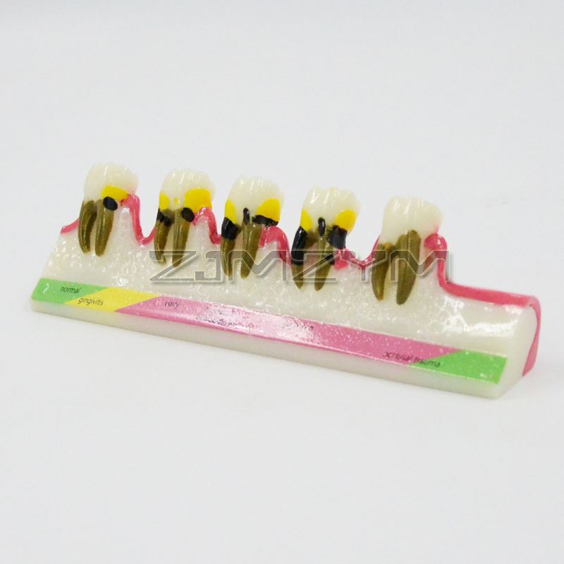 Modelo de enfermedad Periodont - Medical Lab Study reseña y precio