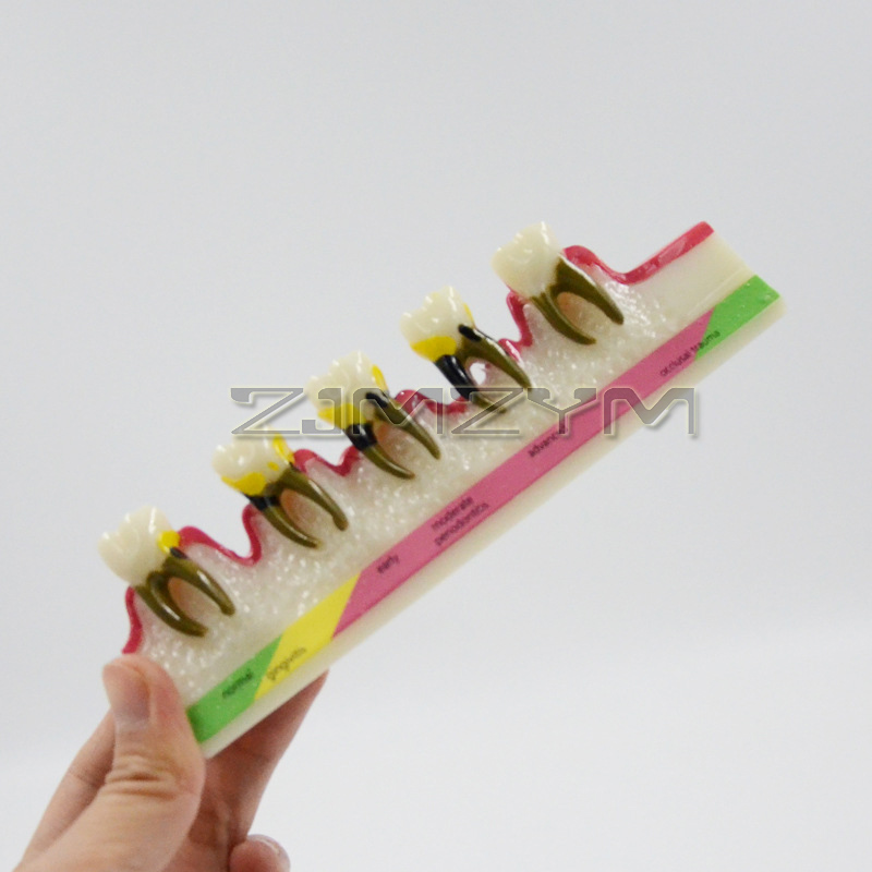 Modelo de enfermedad Periodont - Medical Lab Study reseña y precio